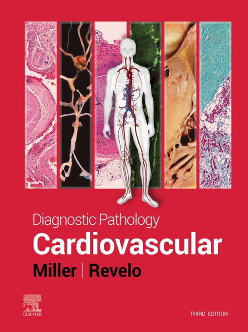 Diagnostic Pathology: Cardiovascular, 3rd Edition (EPUB)