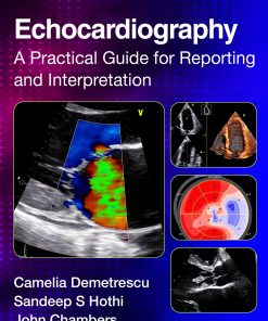 Echocardiography: A Practical Guide for Reporting and Interpretation, 4th Edition (EPUB)