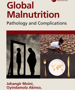 Global Malnutrition: Pathology And Complications (EPUB)