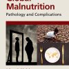 Global Malnutrition: Pathology And Complications (EPUB)