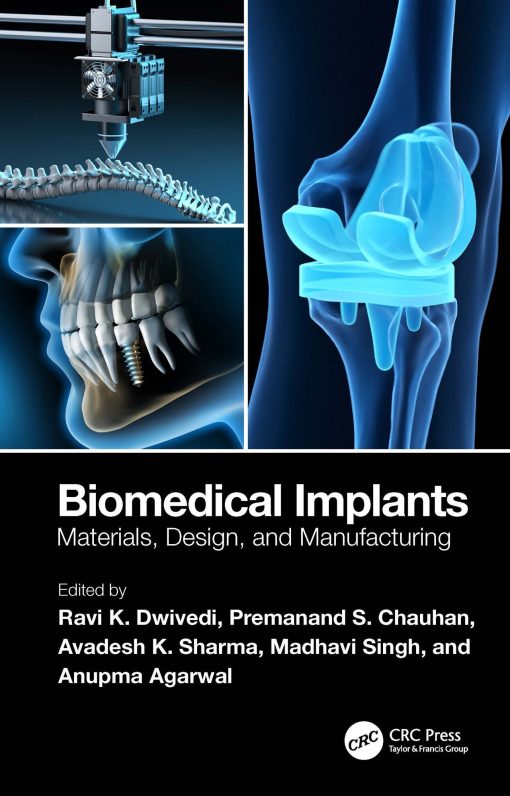 Biomedical Implants: Materials, Design, and Manufacturing (PDF)