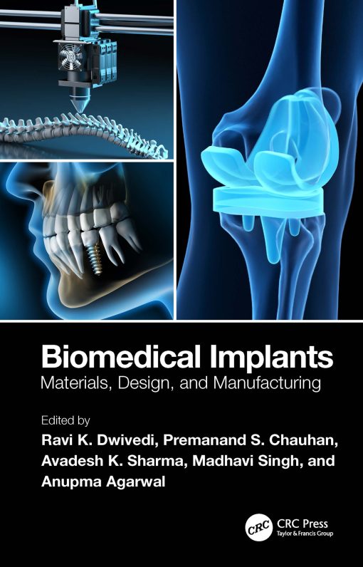 Biomedical Implants: Materials, Design, and Manufacturing (EPUB)