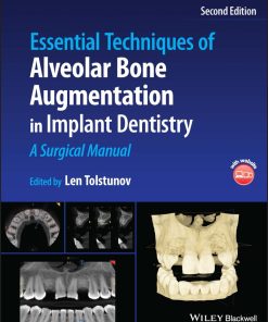 Essential Techniques Of Alveolar Bone Augmentation In Implant Dentistry: A Surgical Manual, 2nd Edition (EPUB)