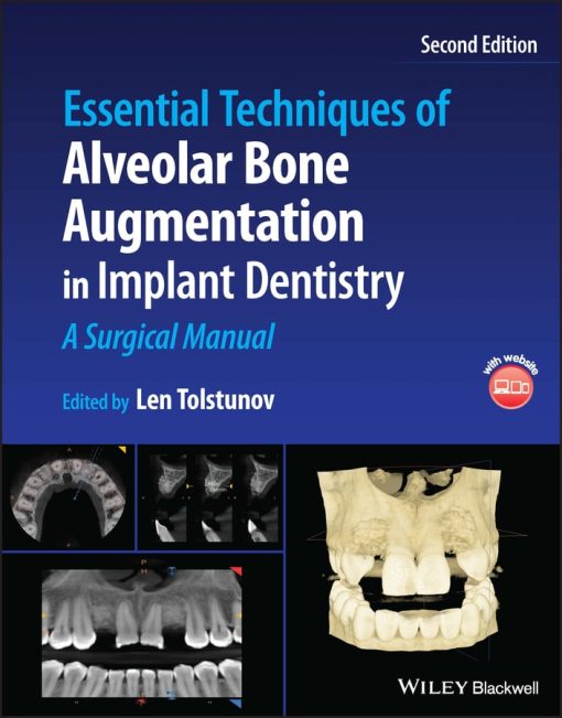 Essential Techniques Of Alveolar Bone Augmentation In Implant Dentistry: A Surgical Manual, 2nd Edition (EPUB)