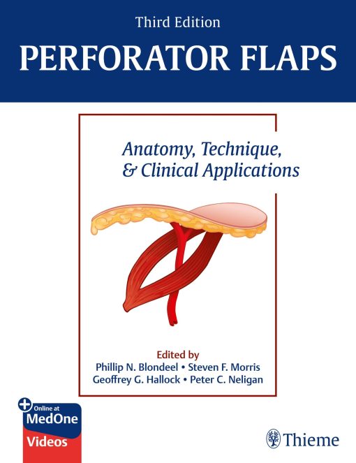 Perforator Flaps: Anatomy, Technique, & Clinical Applications, 3rd Edition (PDF Book+Videos)