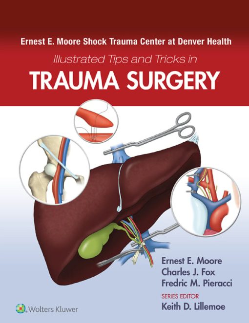 Ernest E. Moore Shock Trauma Center At Denver Health Illustrated Tips And Tricks In Trauma Surgery (EPUB)