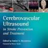 Cerebrovascular Ultrasound in Stroke Prevention and Treatment 2nd Edition (PDF)