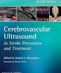 Cerebrovascular Ultrasound in Stroke Prevention and Treatment 2nd Edition (PDF)