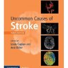 Uncommon Causes of Stroke 3rd Edition (PDF)