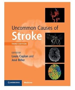 Uncommon Causes of Stroke 3rd Edition (PDF)