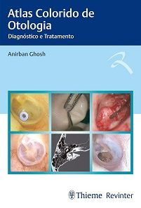 Atlas Colorido De Otologia: Diagnóstico E Tratamento (Portuguese Edition) (EPUB)