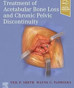 Treatment Of Acetabular Bone Loss And Chronic Pelvic Discontinuity (EPUB)