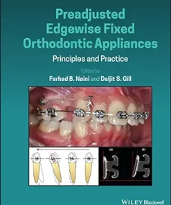 Preadjusted Edgewise Fixed Orthodontic Appliances: Principles And Practice (EPUB)