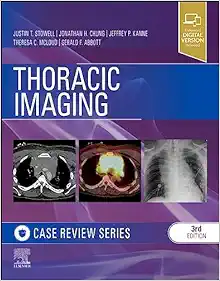 Thoracic Imaging: Case Review, 3rd Edition (PDF)