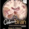 Osborn’s Brain, 3rd Edition (EPUB)