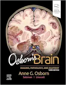 Osborn’s Brain, 3rd Edition (EPUB)