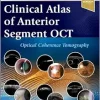 Clinical Atlas Of Anterior Segment OCT: Optical Coherence Tomography (EPUB)