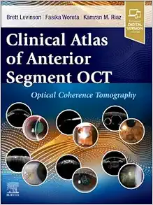 Clinical Atlas Of Anterior Segment OCT: Optical Coherence Tomography (EPUB)