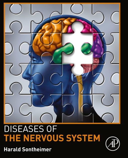 Diseases Of The Nervous System (EPUB)