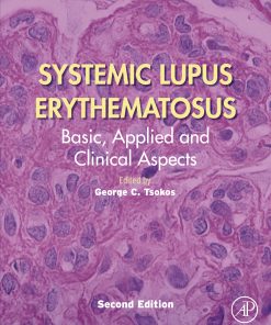 Systemic Lupus Erythematosus: Basic, Applied And Clinical Aspects, 2nd Edition (PDF)