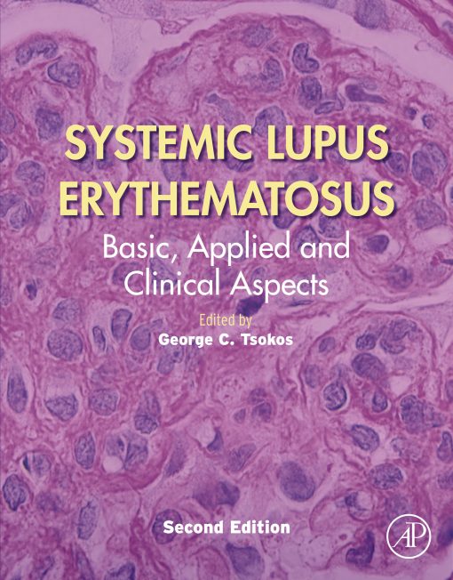 Systemic Lupus Erythematosus: Basic, Applied And Clinical Aspects, 2nd Edition (PDF)