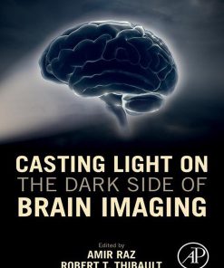 Casting Light On The Dark Side Of Brain Imaging (PDF)