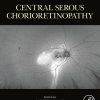 Central Serous Chorioretinopathy (EPUB)