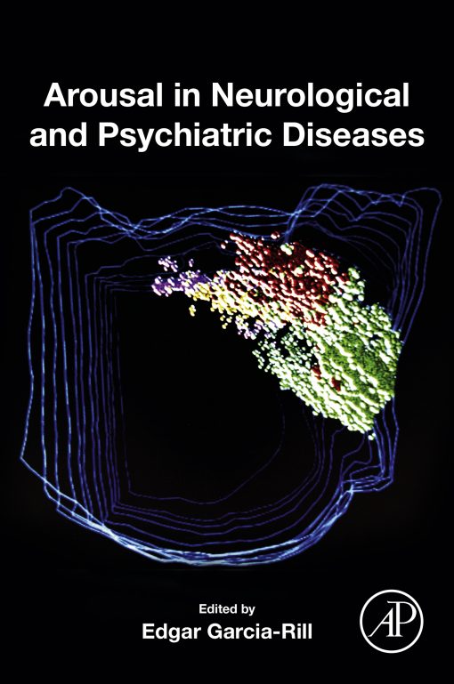 Arousal In Neurological And Psychiatric Diseases (EPUB)