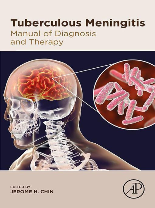 Tuberculous Meningitis: Manual Of Diagnosis And Therapy (EPUB)