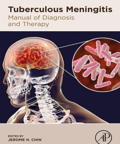 Tuberculous Meningitis: Manual Of Diagnosis And Therapy (PDF)