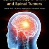 Epidemiology Of Brain And Spinal Tumors (EPUB)