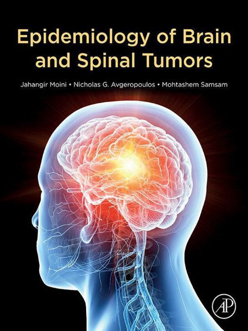 Epidemiology Of Brain And Spinal Tumors (EPUB)