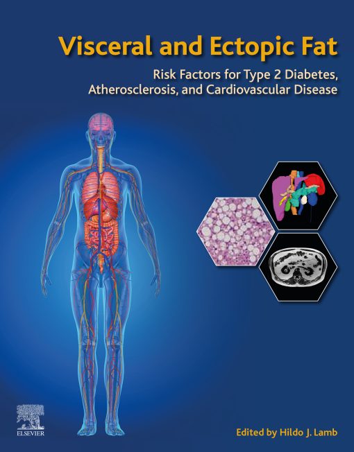 Visceral And Ectopic Fat: Risk Factors For Type 2 Diabetes, Atherosclerosis, And Cardiovascular Disease (EPUB)