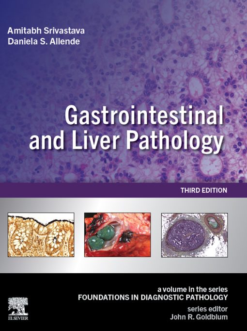 Gastrointestinal And Liver Pathology: A Volume In The Series: Foundations In Diagnostic Pathology, 3rd Edition (EPUB)