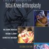 The Technique Of Total Knee Arthroplasty, 2nd Edition (EPUB)