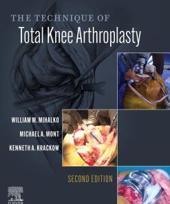 The Technique Of Total Knee Arthroplasty, 2nd Edition (EPUB)