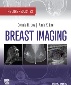 Breast Imaging: The Core Requisites, 4th Edition (EPUB)