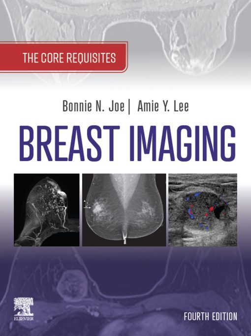 Breast Imaging: The Core Requisites, 4th Edition (EPUB)