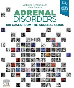 Adrenal Disorders: Cases From The Adrenal Clinic (EPUB)