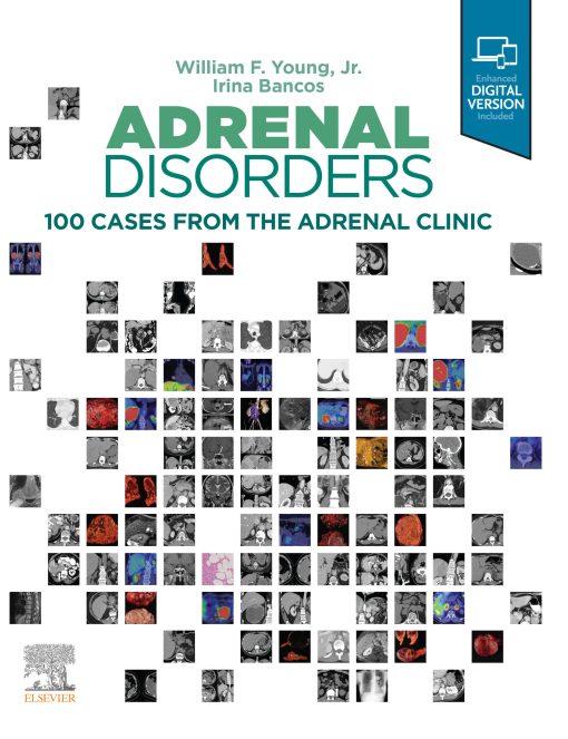 Adrenal Disorders: Cases From The Adrenal Clinic (EPUB)