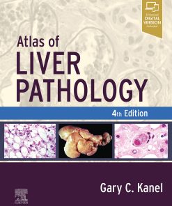 Atlas Of Liver Pathology, 4th Edition (EPUB)