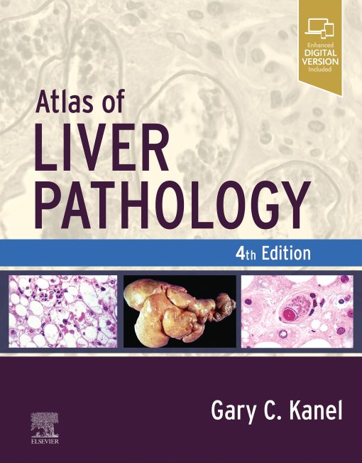 Atlas Of Liver Pathology, 4th Edition (EPUB)