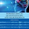 Nanowired Delivery Of Drugs And Antibodies For Neuroprotection In Brain Diseases With Co-Morbidity Factors Part A, Volume 171 (EPUB)