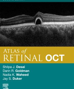 Atlas Of Retinal OCT E-Book: Optical Coherence Tomography, 2nd Edition (EPUB)