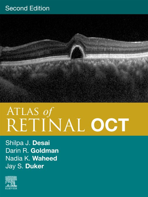 Atlas Of Retinal OCT E-Book: Optical Coherence Tomography, 2nd Edition (EPUB)