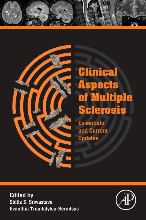 Clinical Aspects Of Multiple Sclerosis Essentials And Current Updates (EPUB)