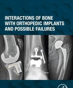 Interactions Of Bone With Orthopedic Implants And Possible Failures (PDF)