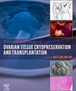 Principles And Practice Of Ovarian Tissue Cryopreservation And Transplantation (EPUB)