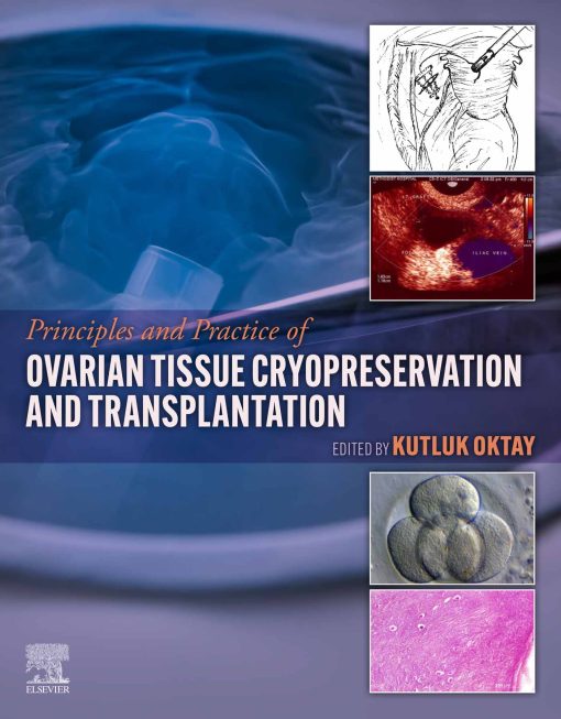 Principles And Practice Of Ovarian Tissue Cryopreservation And Transplantation (EPUB)