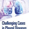 Challenging Cases In Pleural Diseases (EPUB)